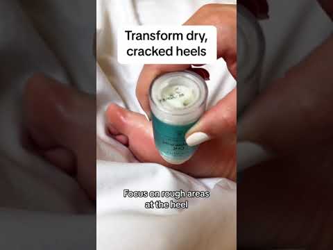 Foot Balm, Cool Peppermint, healing, rough and cracked heels and feet, 100% natural, all natural, Roll-on application, No Stickiness, Paraben-free, phthalte-free, hapy feet, coconut oil, peppermint oil, shea butter, rough skin, dry skin, sark spots, friction, weather changes, moisturize, joviality, egypt, international, skincare, lifestyle, reel